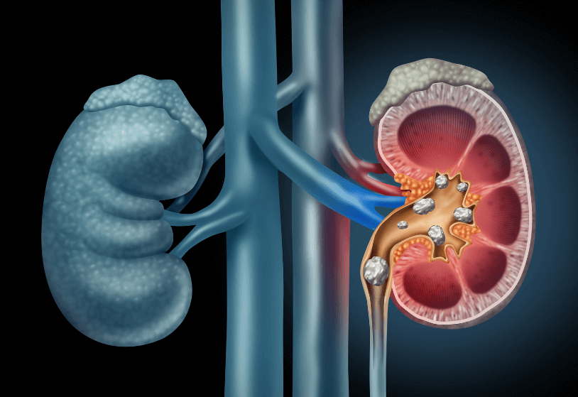 Tips for Maintaining Healthy Kidneys