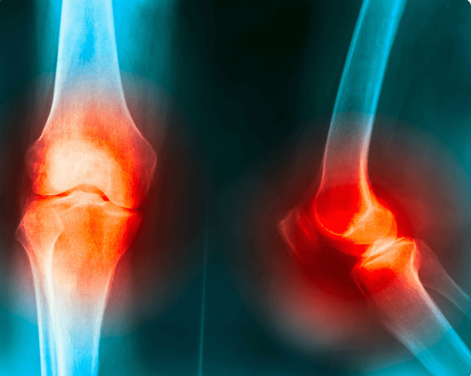 How to Maintain Joint Flexibility
